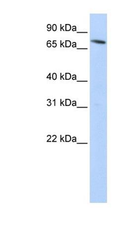 Western Blot: NRAMP2/SLC11A2/DMT1 Antibody [NBP1-59869] - HepG2 cell lysate, concentration 0.2-1 ug/ml.