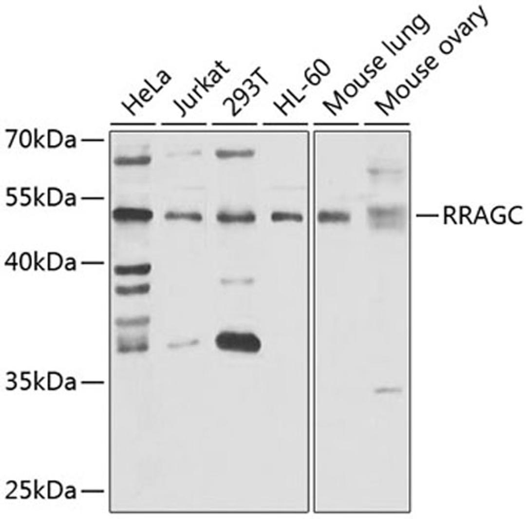 Western blot - RRAGC antibody (A7479)