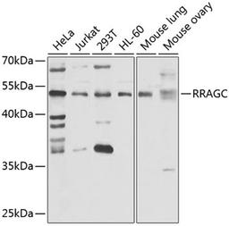 Western blot - RRAGC antibody (A7479)