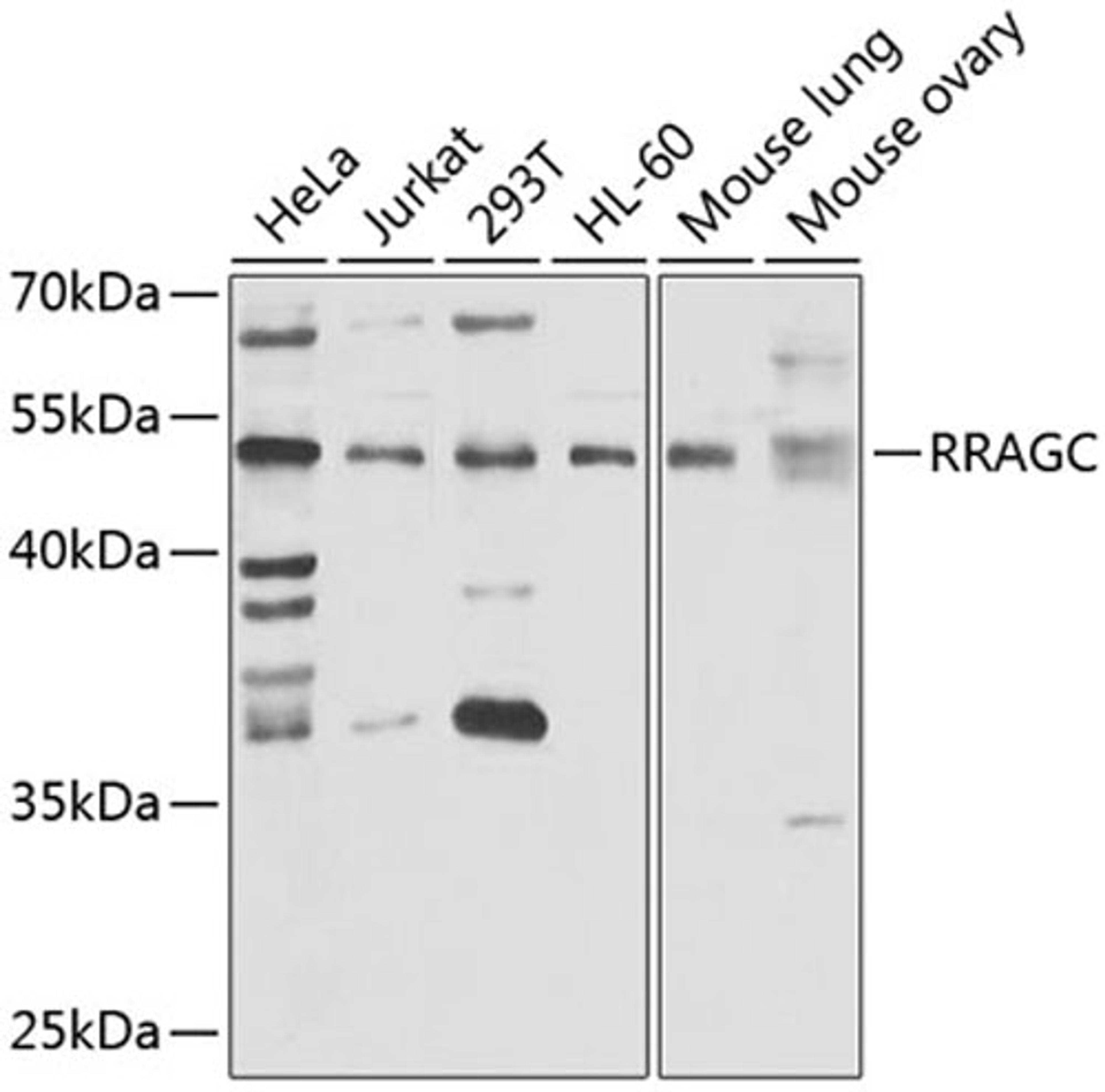 Western blot - RRAGC antibody (A7479)