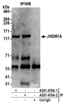 Detection of human JHDM1A by western blot of immunoprecipitates.