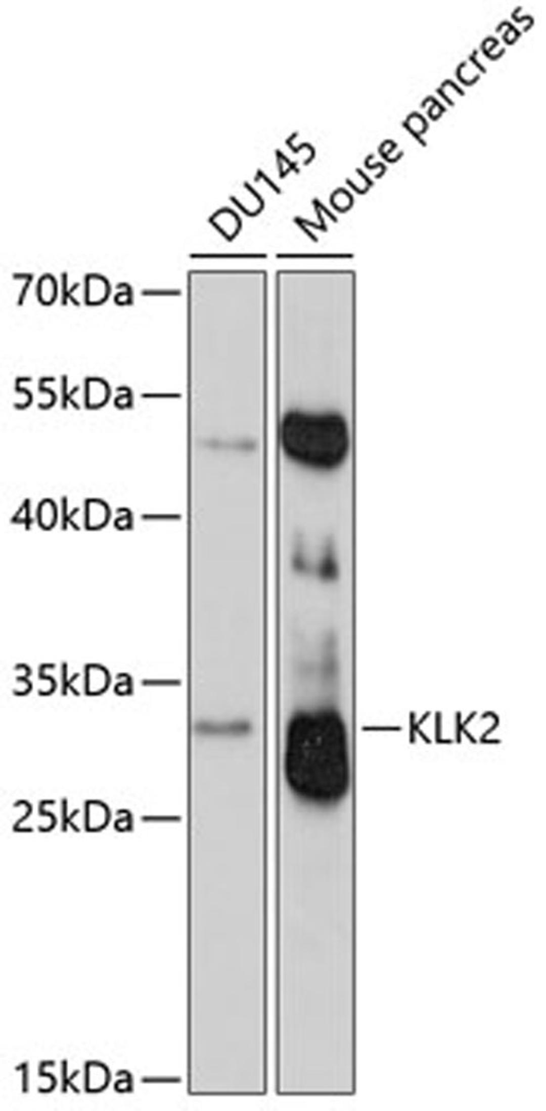 Western blot - KLK2 antibody (A2990)