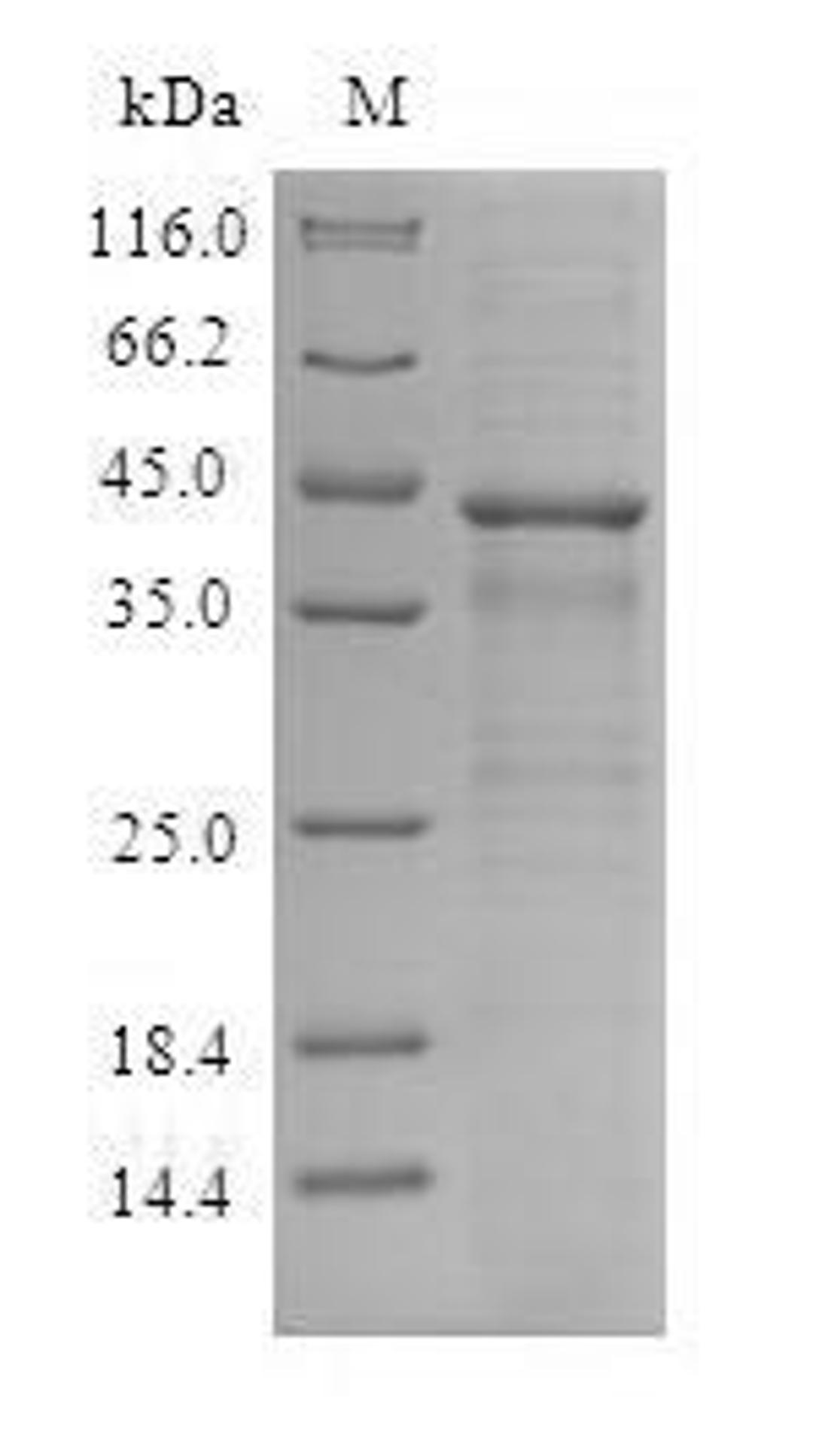 (Tris-Glycine gel) Discontinuous SDS-PAGE (reduced) with 5% enrichment gel and 15% separation gel.