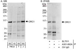 Detection of human ORC1 by western blot and immunoprecipitation.