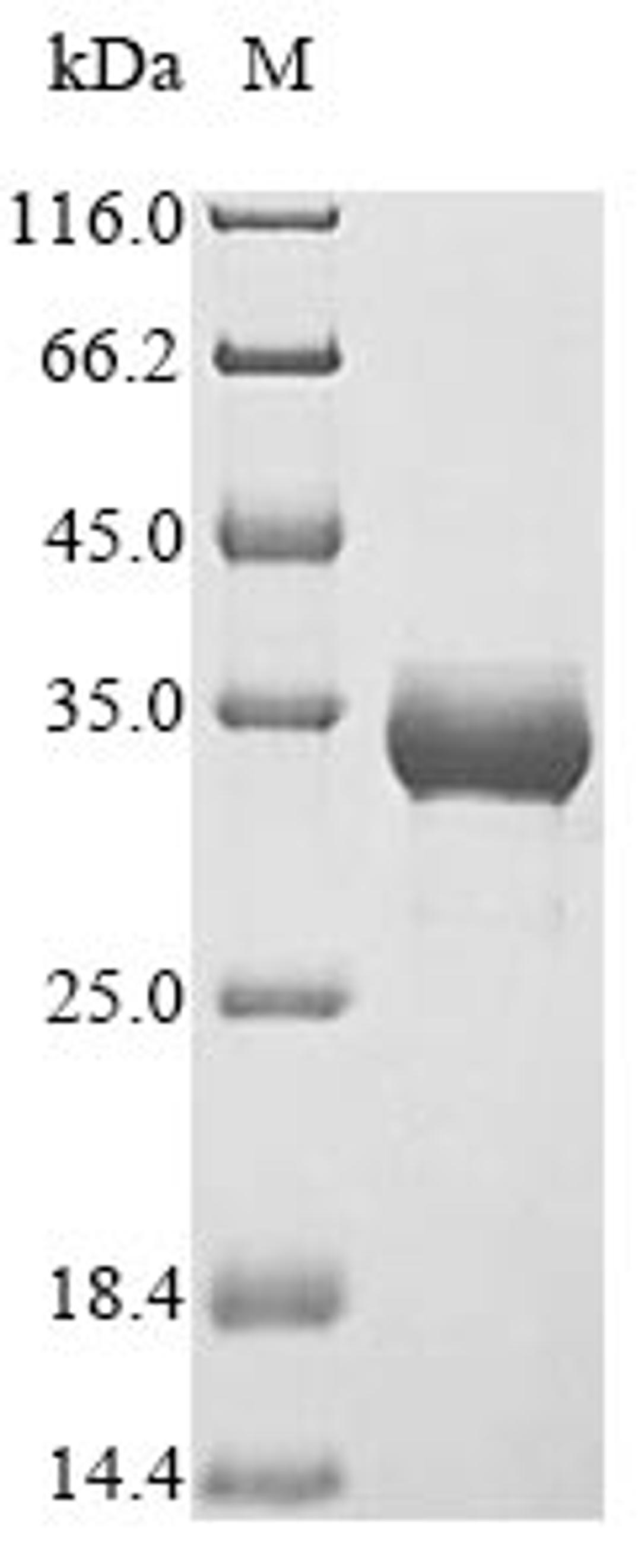 (Tris-Glycine gel) Discontinuous SDS-PAGE (reduced) with 5% enrichment gel and 15% separation gel.