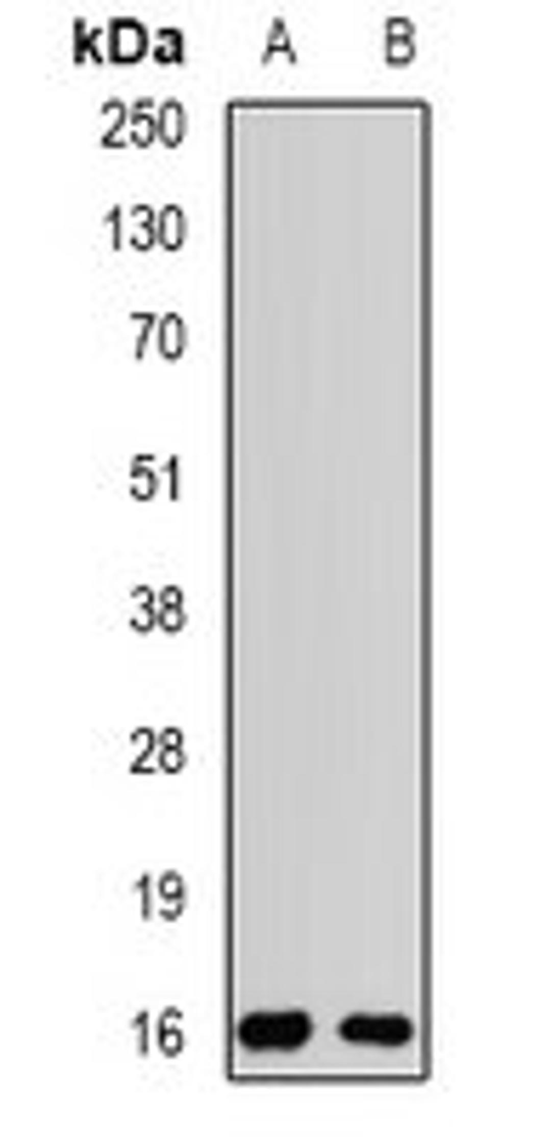 Western blot analysis of MCF7 (Lane1), SW480 (Lane2) whole cell lysates using POP7 antibody