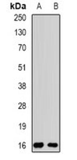 Western blot analysis of MCF7 (Lane1), SW480 (Lane2) whole cell lysates using POP7 antibody