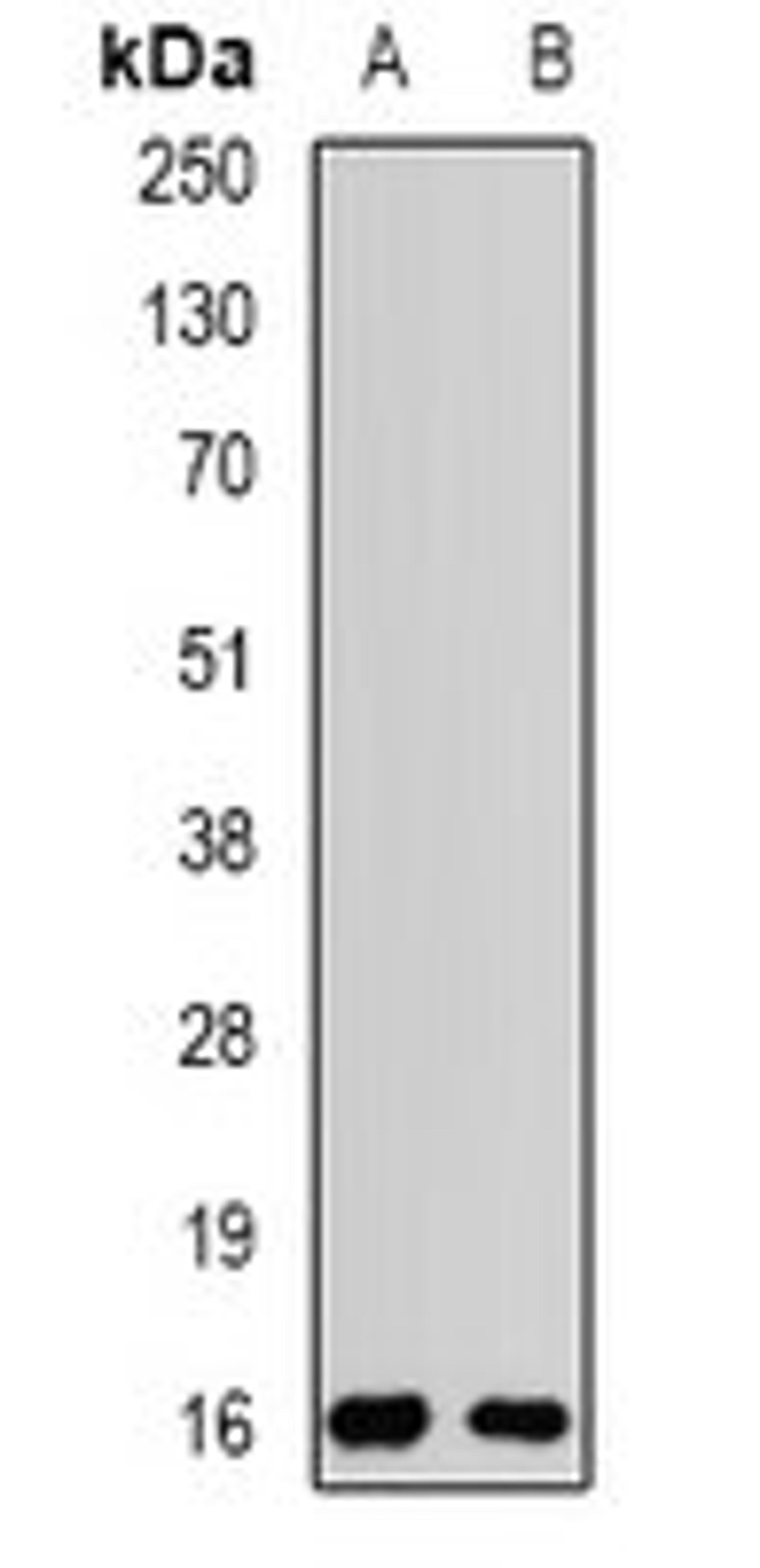 Western blot analysis of MCF7 (Lane1), SW480 (Lane2) whole cell lysates using POP7 antibody