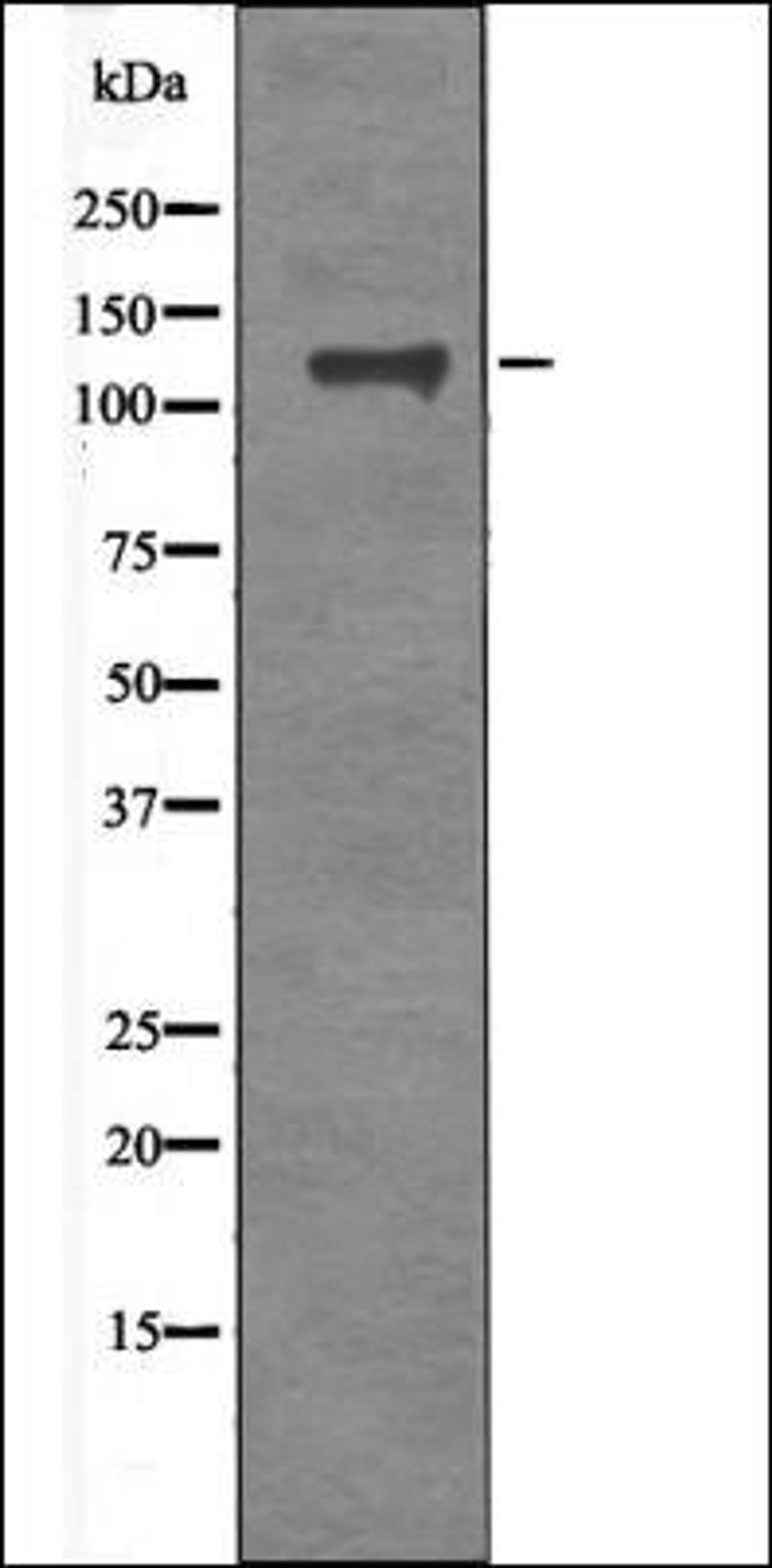 Western blot analysis of TNF- treated HeLa whole cell lysates using FAK -Phospho-Tyr577- antibody