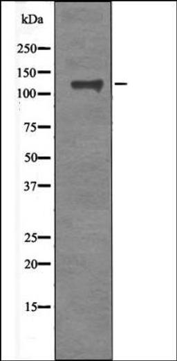 Western blot analysis of TNF- treated HeLa whole cell lysates using FAK -Phospho-Tyr577- antibody