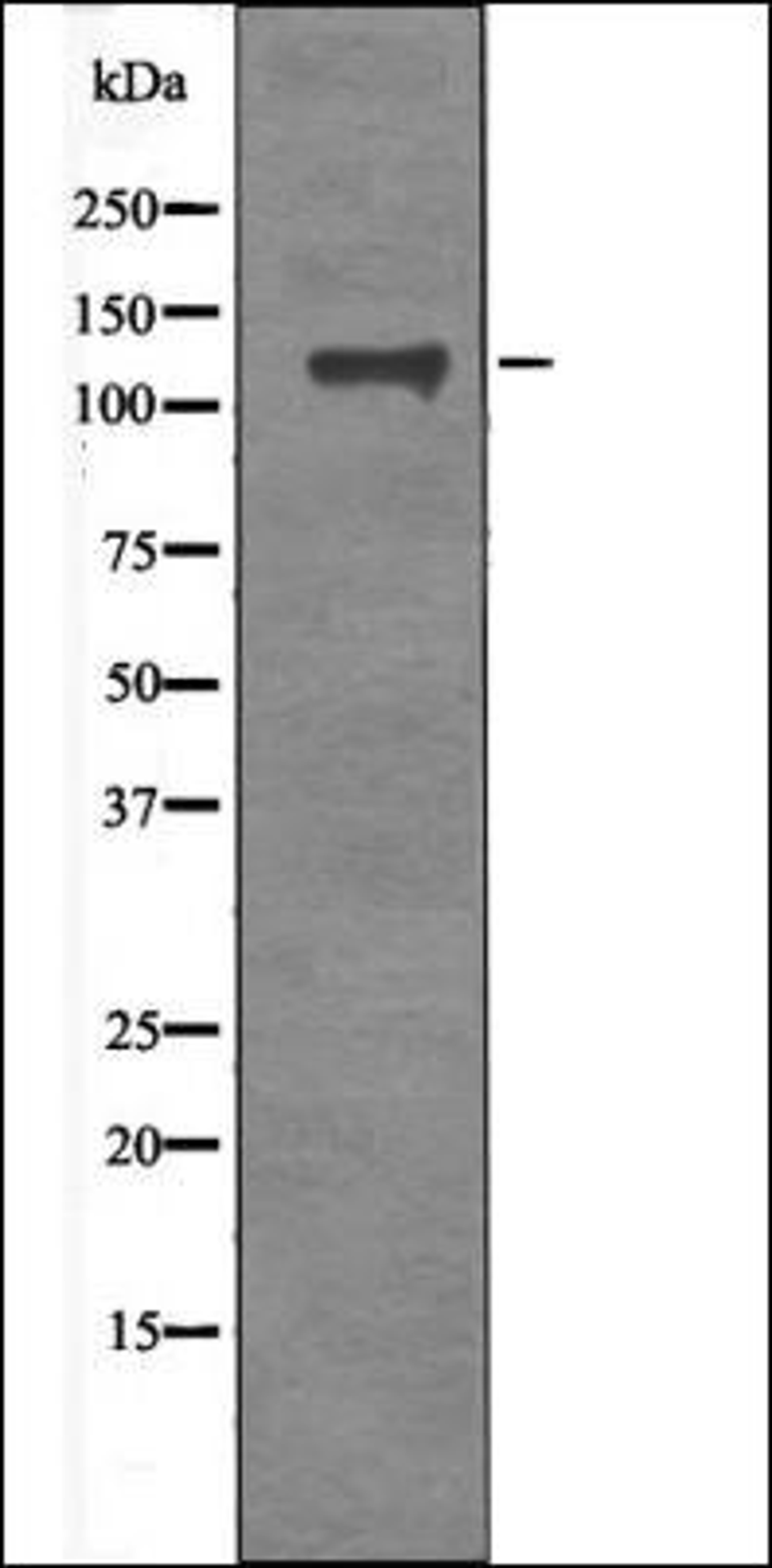 Western blot analysis of TNF- treated HeLa whole cell lysates using FAK -Phospho-Tyr577- antibody