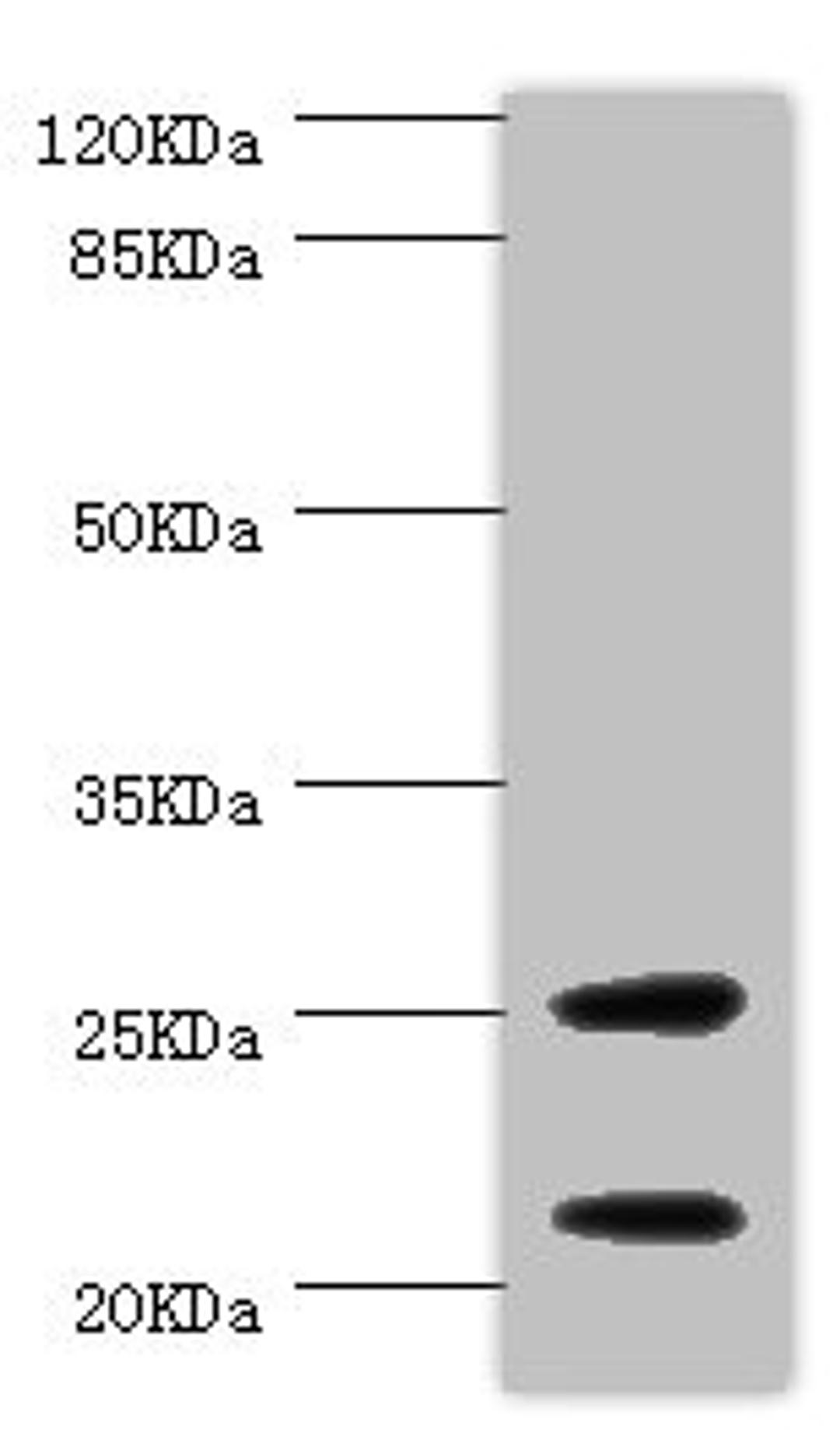 Western blot. All lanes: CSRP3 antibody at 1ug/ml + Mouse skeletal muscle tissue. Secondary. Goat polyclonal to rabbit IgG at 1/10000 dilution. Predicted band size: 21 kDa. Observed band size: 21, 25 kDa. 