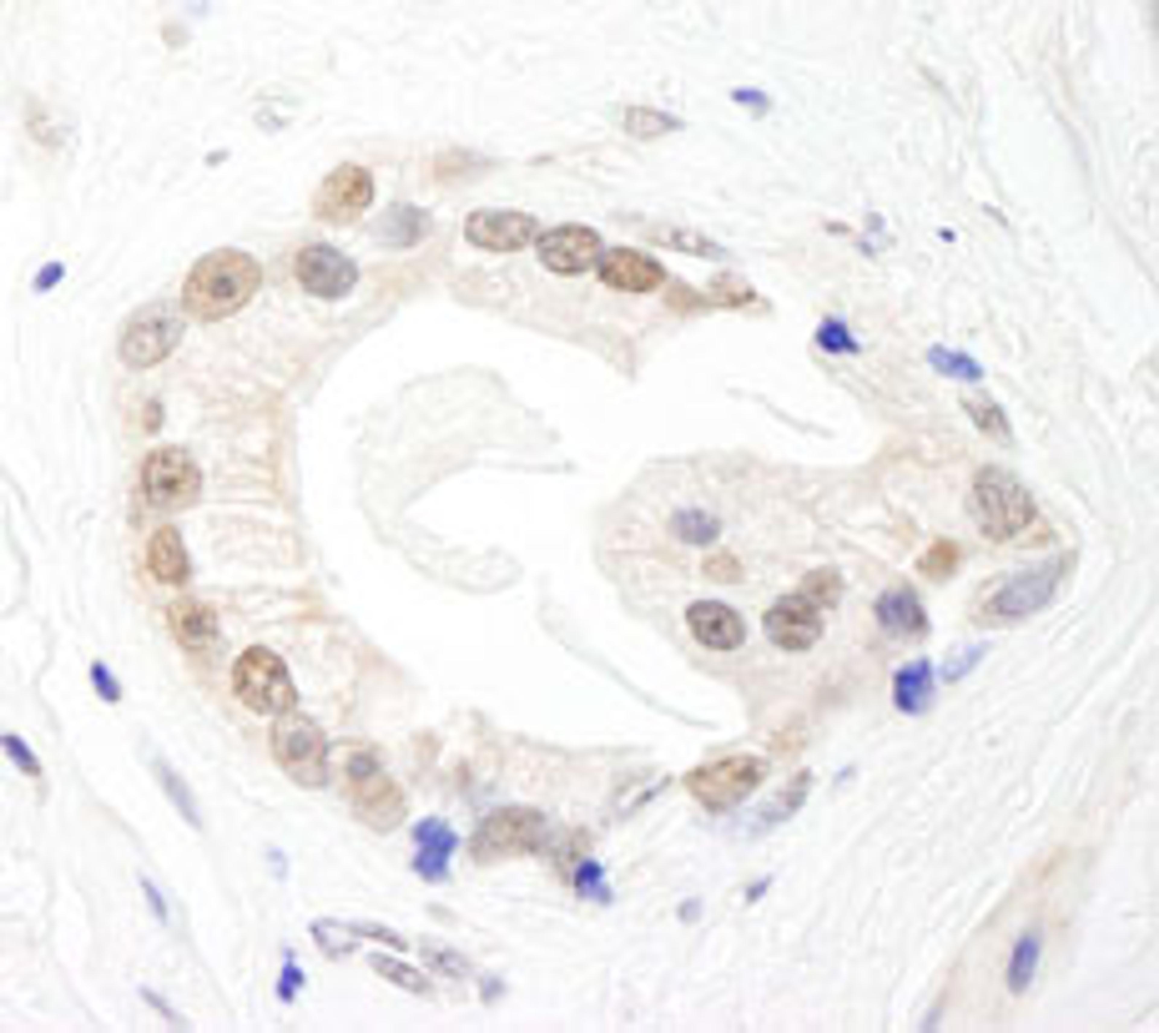 Detection of human BRF1 by immunohistochemistry.