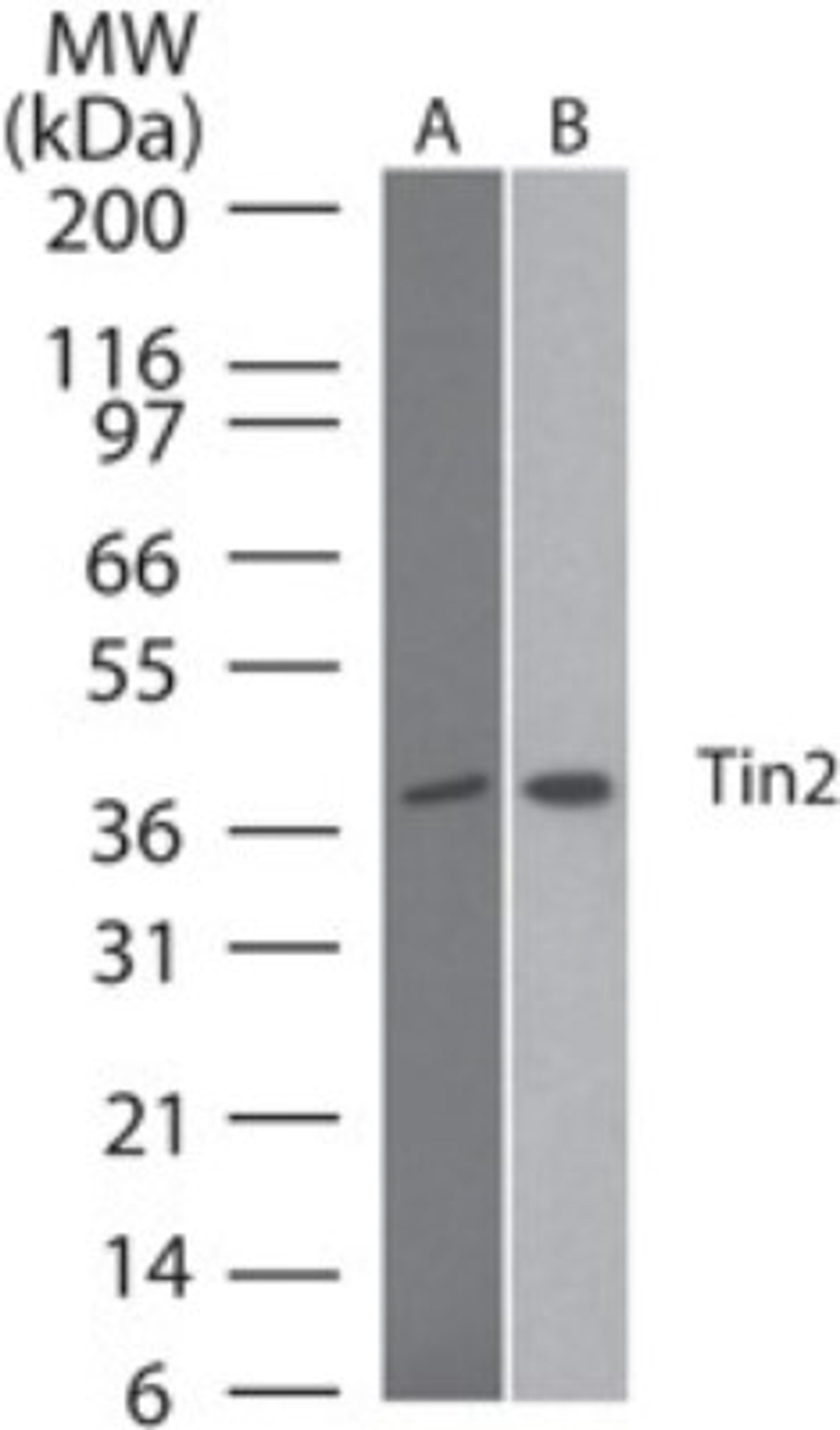 Western Blot: TIN2 Antibody (59B388.1) [NB600-1522] - Analysis of Tin2 using Tin2 monoclonal antibody 59B388.1. Human Daudi (A) and mouse NIH 3T3 lysate probed using Tin2 antibody at 2 ug/ml.