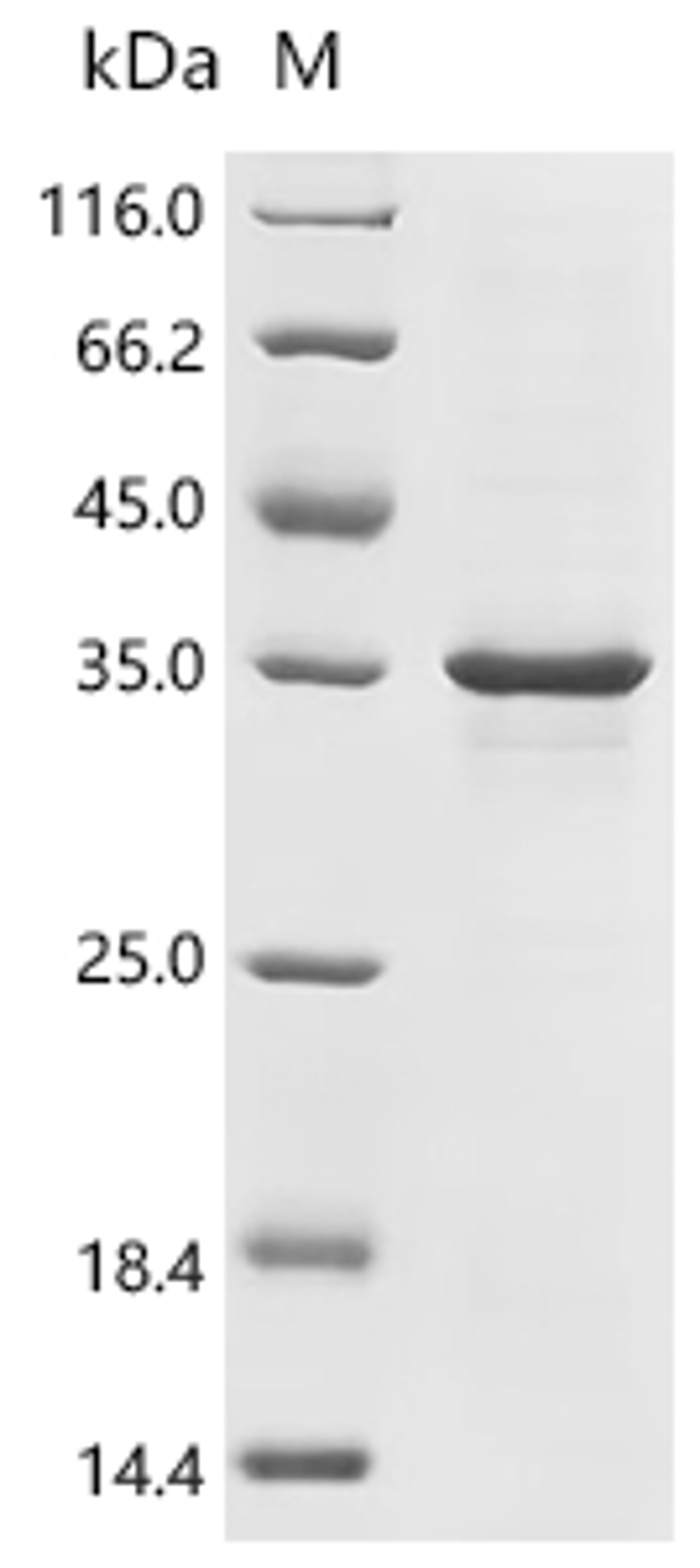 (Tris-Glycine gel) Discontinuous SDS-PAGE (reduced) with 5% enrichment gel and 15% separation gel.