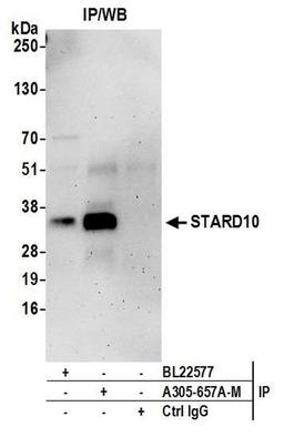 Detection of human STARD10 by WB of IP.