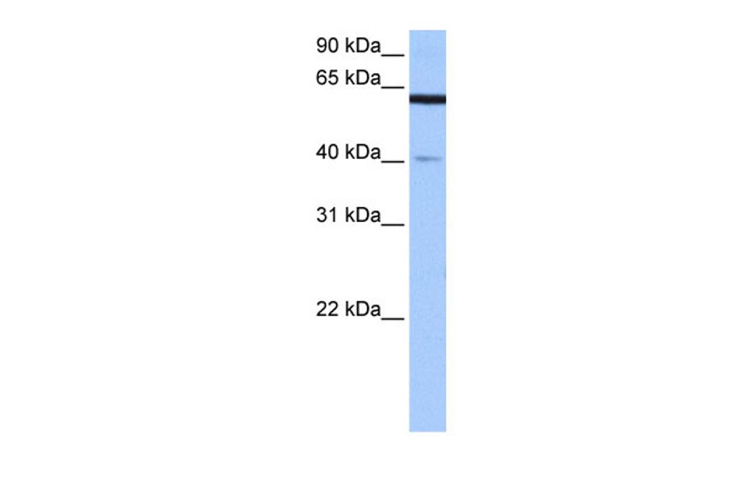 Antibody used in WB on Human Brain at 0.2-1 ug/ml.