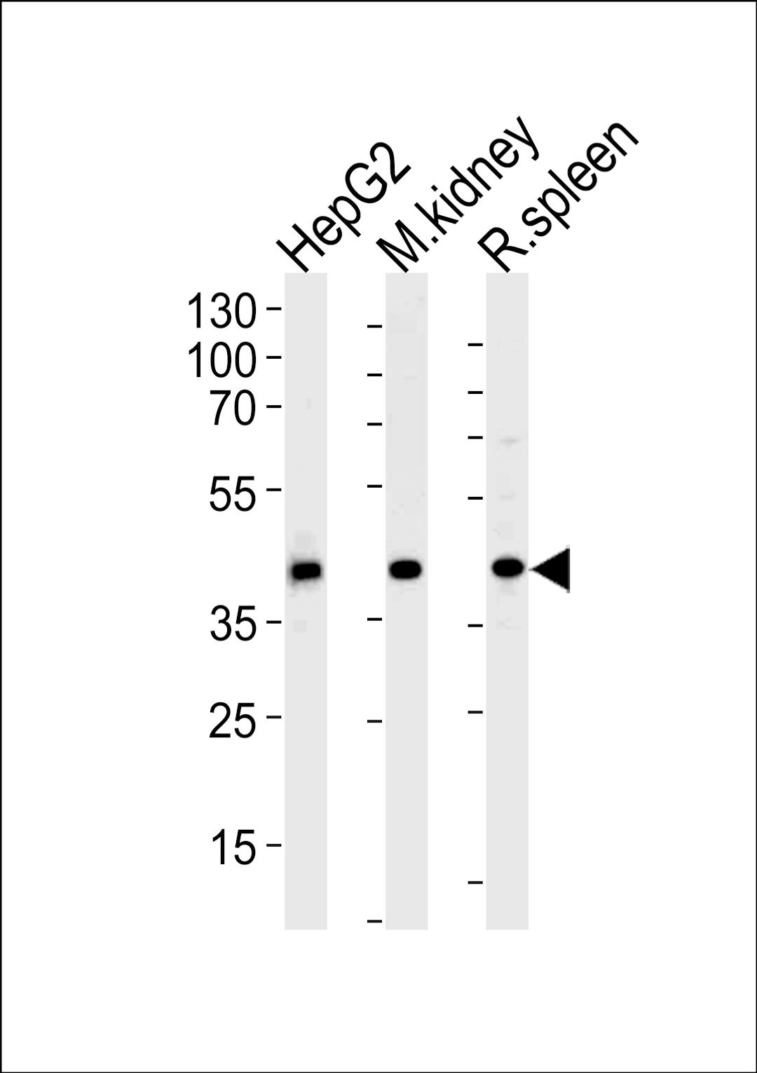 Western blot analysis of lysates from HepG2 cell line and mouse kidney, rat spleen tissue lysates(from left to right), using ACADL Antibody at 1:1000 at each lane.