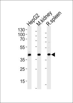 Western blot analysis of lysates from HepG2 cell line and mouse kidney, rat spleen tissue lysates(from left to right), using ACADL Antibody at 1:1000 at each lane.