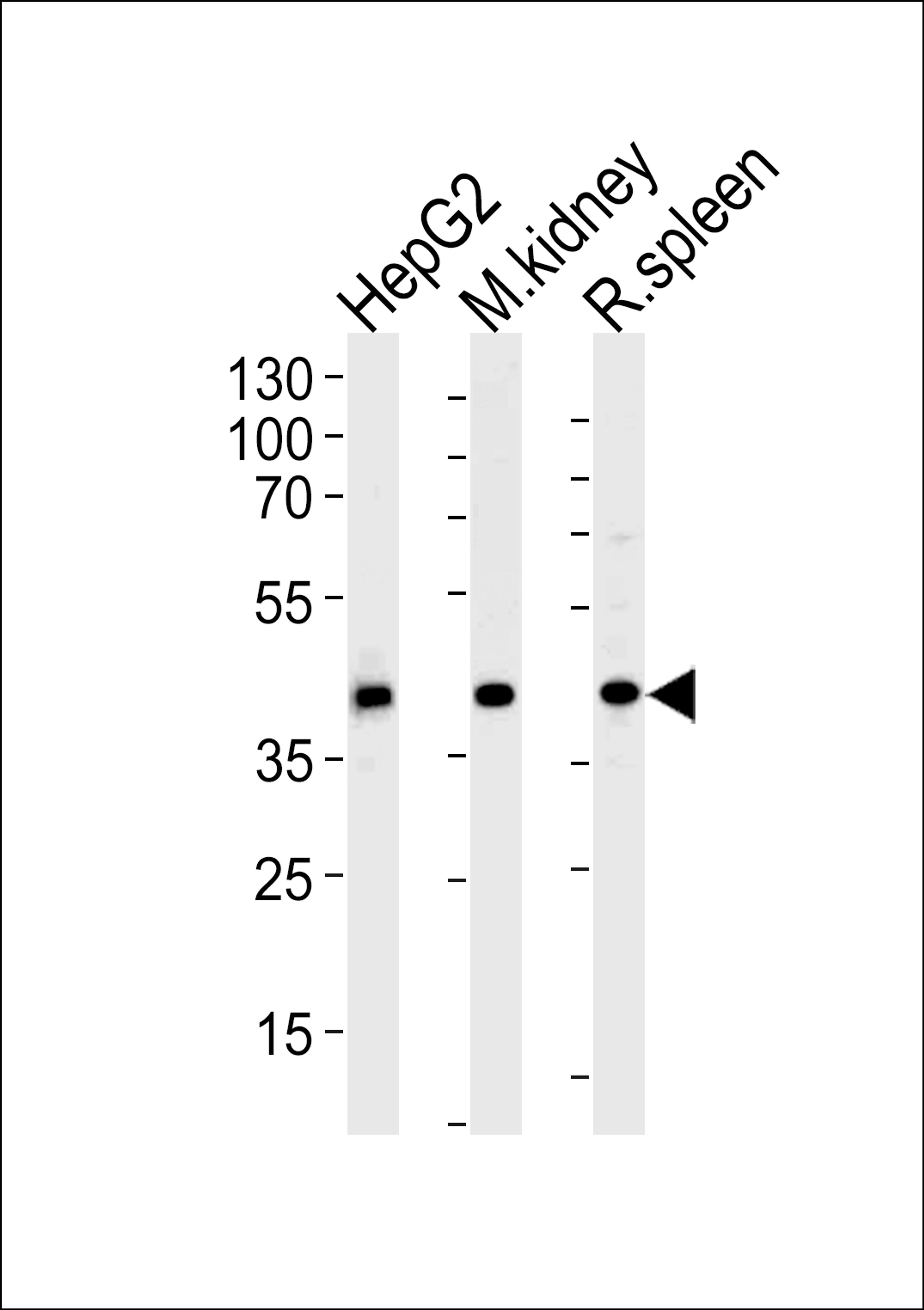 Western blot analysis of lysates from HepG2 cell line and mouse kidney, rat spleen tissue lysates(from left to right), using ACADL Antibody at 1:1000 at each lane.