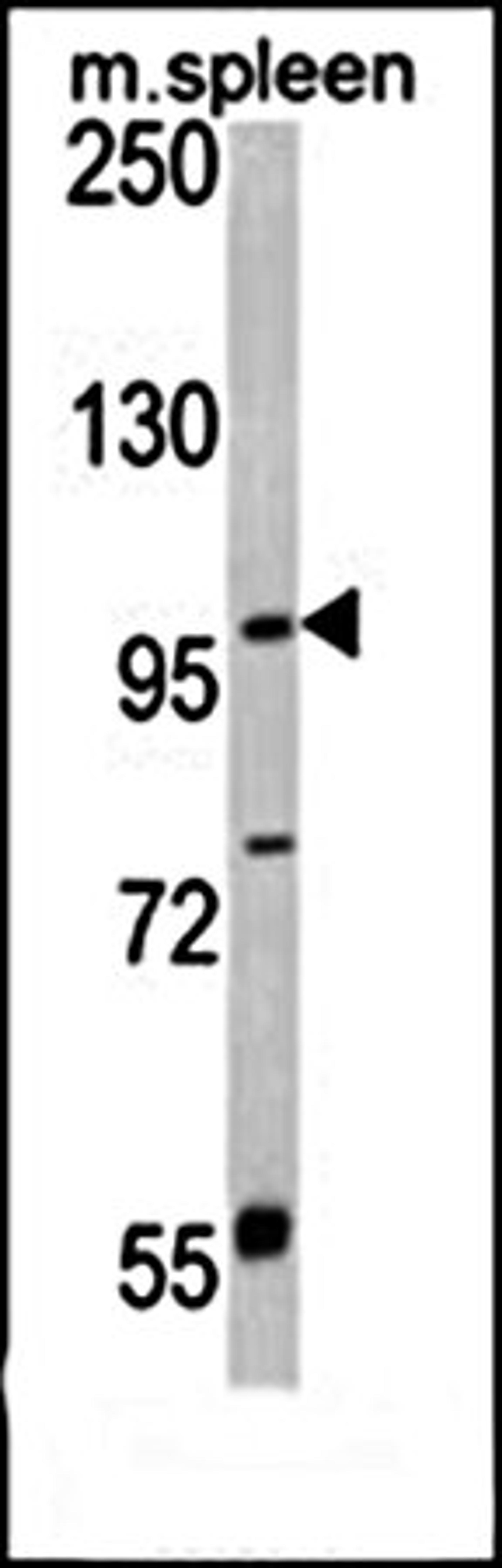 Western blot analysis of ANO5 antibody in mouse spleen tissue lysates