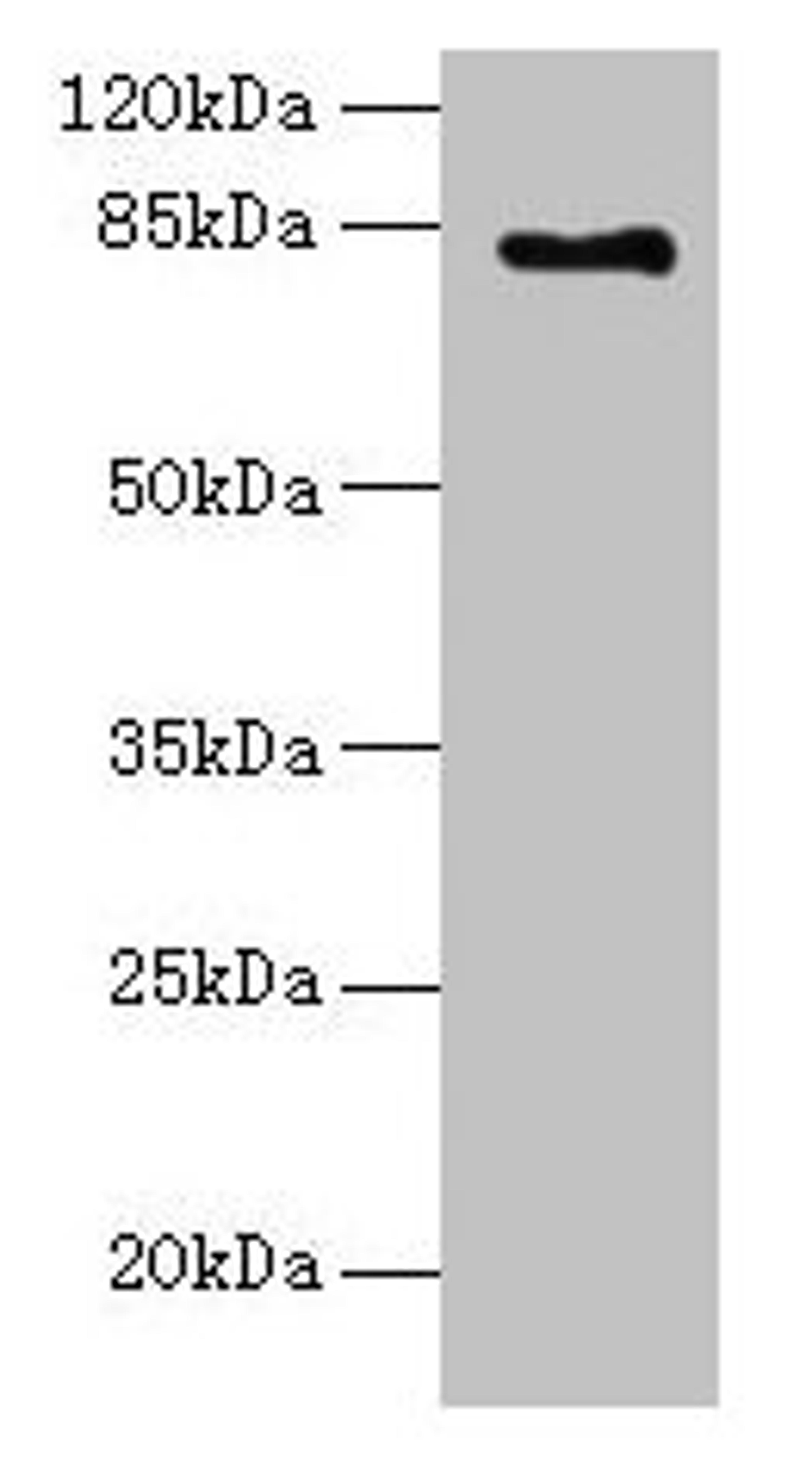 Western blot. All lanes: LCA5 antibody at 18µg/ml + Mouse kidney tissue. Secondary. Goat polyclonal to rabbit IgG at 1/10000 dilution. Predicted band size: 81 kDa. Observed band size: 81 kDa