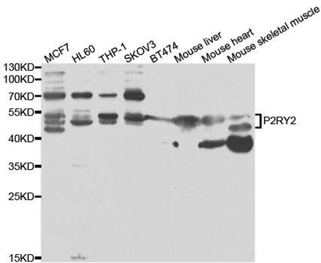 Western blot analysis of extracts of various cell lines using P2RY2 antibody