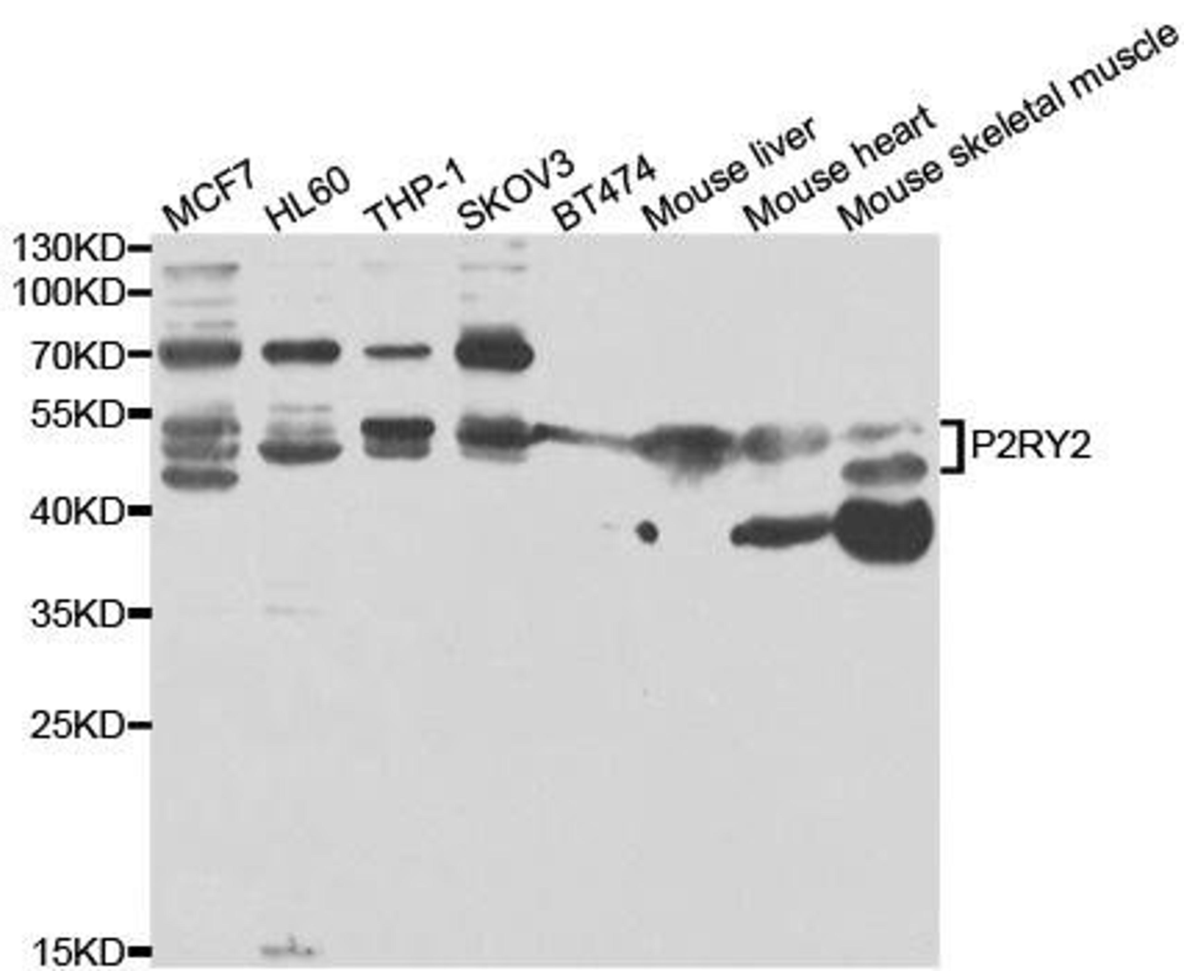 Western blot analysis of extracts of various cell lines using P2RY2 antibody