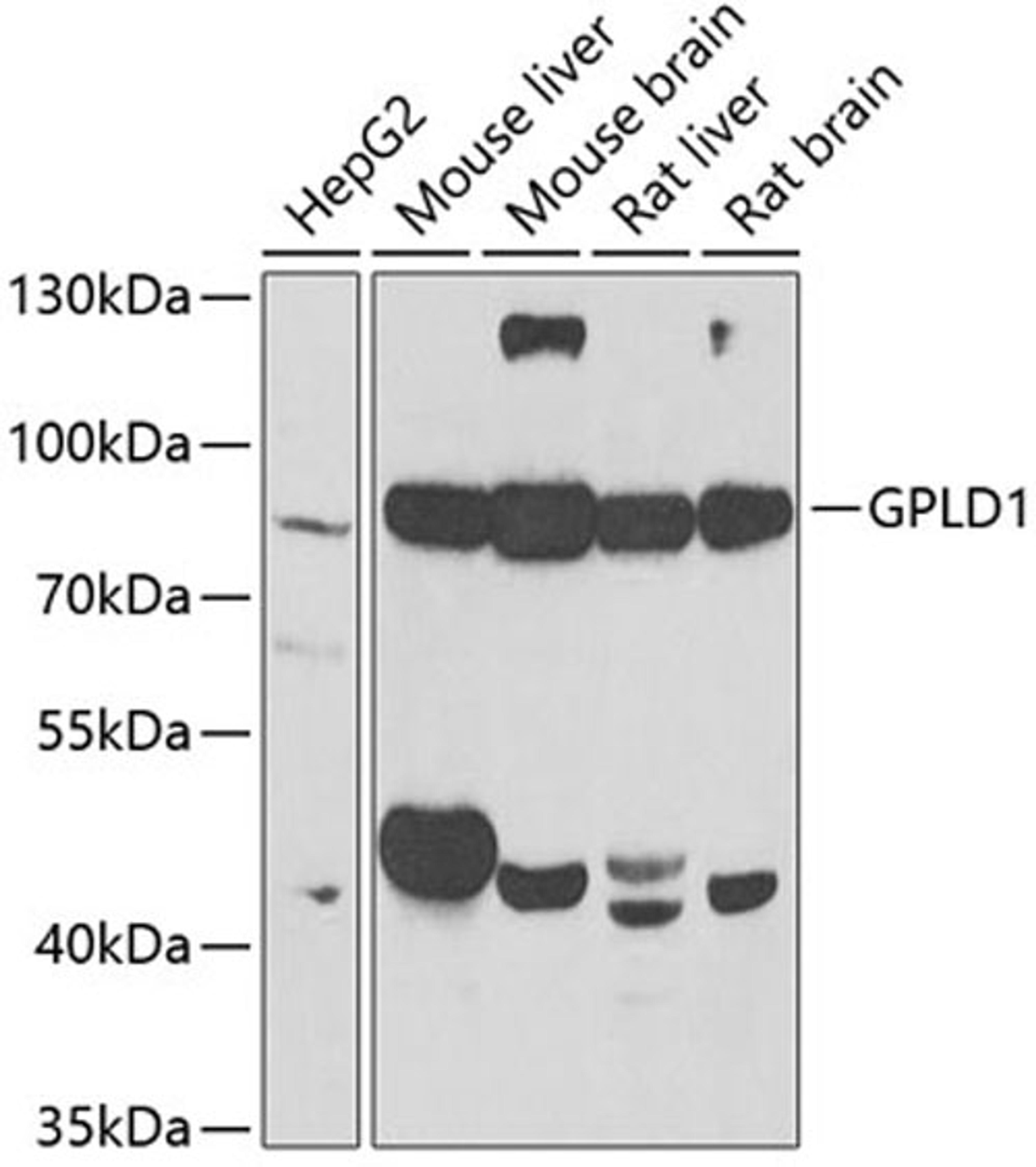 Western blot - GPLD1 antibody (A6612)