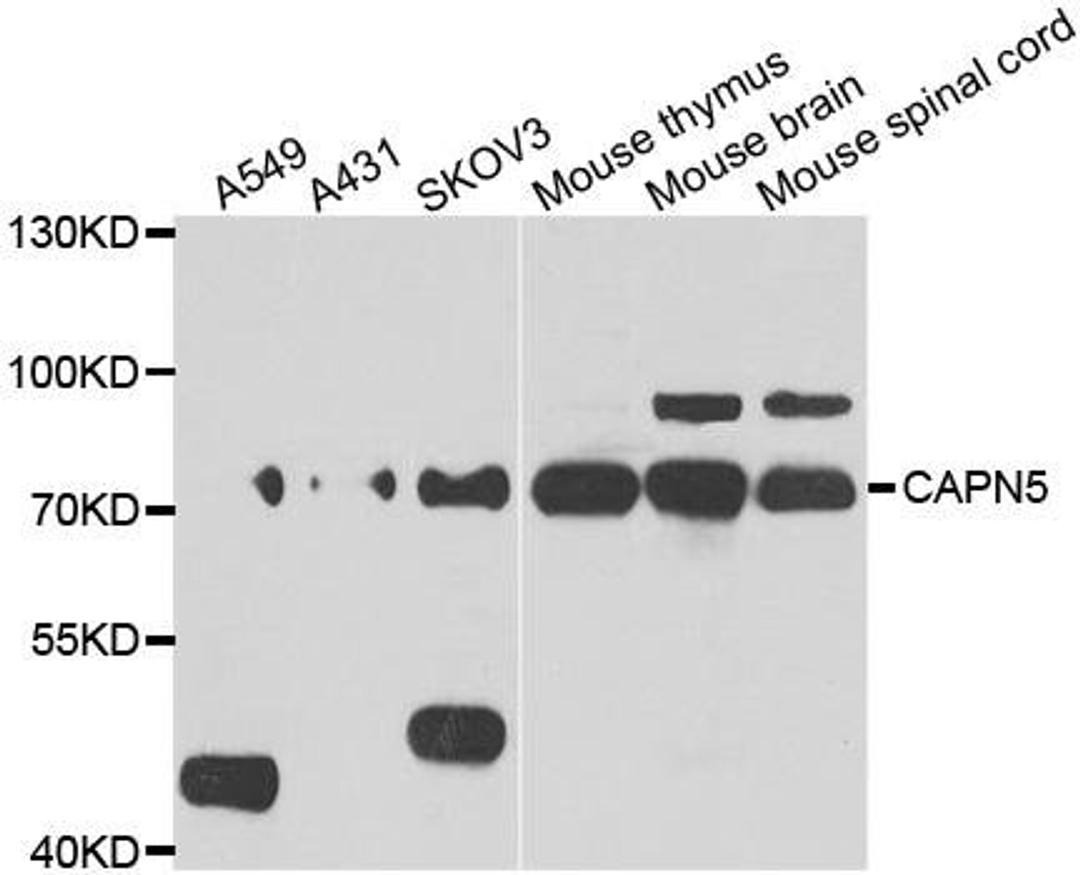 Western blot analysis of extracts of various cell lines using CAPN5 antibody