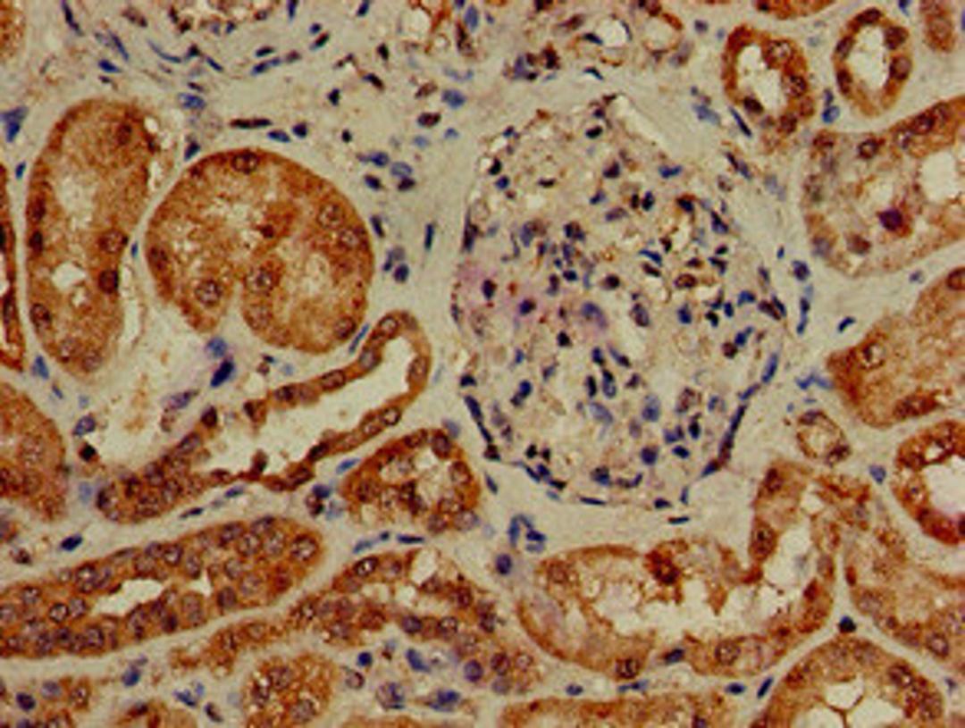 Immunohistochemistry of paraffin-embedded human kidney tissue using CSB-PA858716LA01HU at dilution of 1:100
