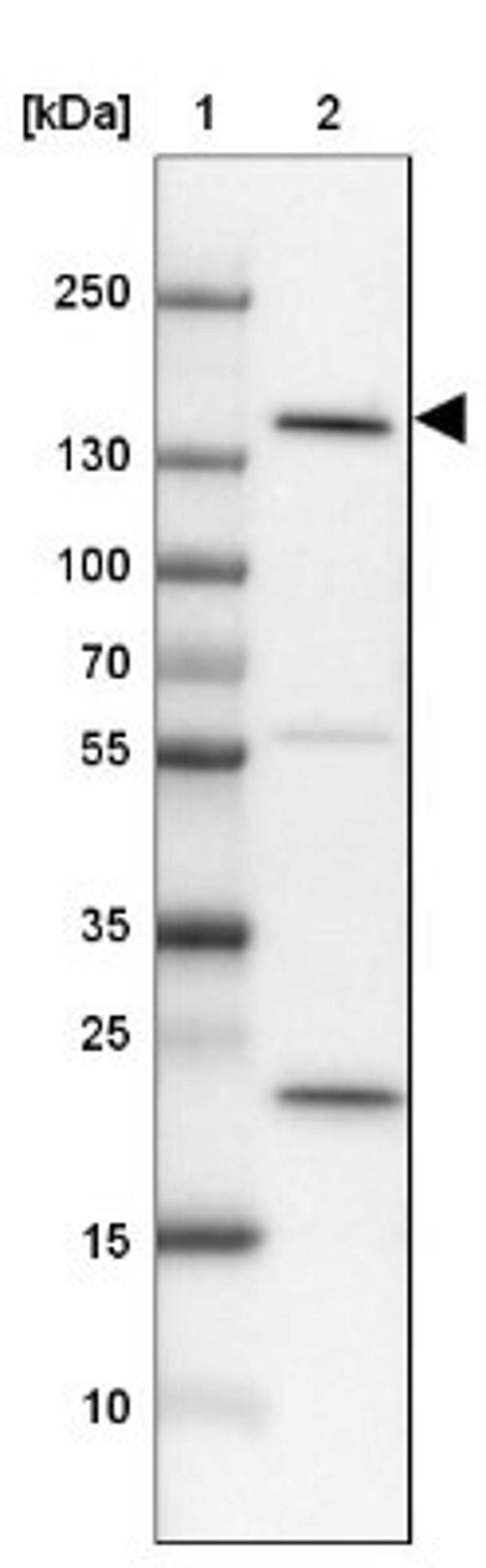 Western Blot: SRGAP3 Antibody [NBP1-88831] - Lane 1: Marker [kDa] 250, 130, 100, 70, 55, 35, 25, 15, 10<br/>Lane 2: Cerebral Cortex