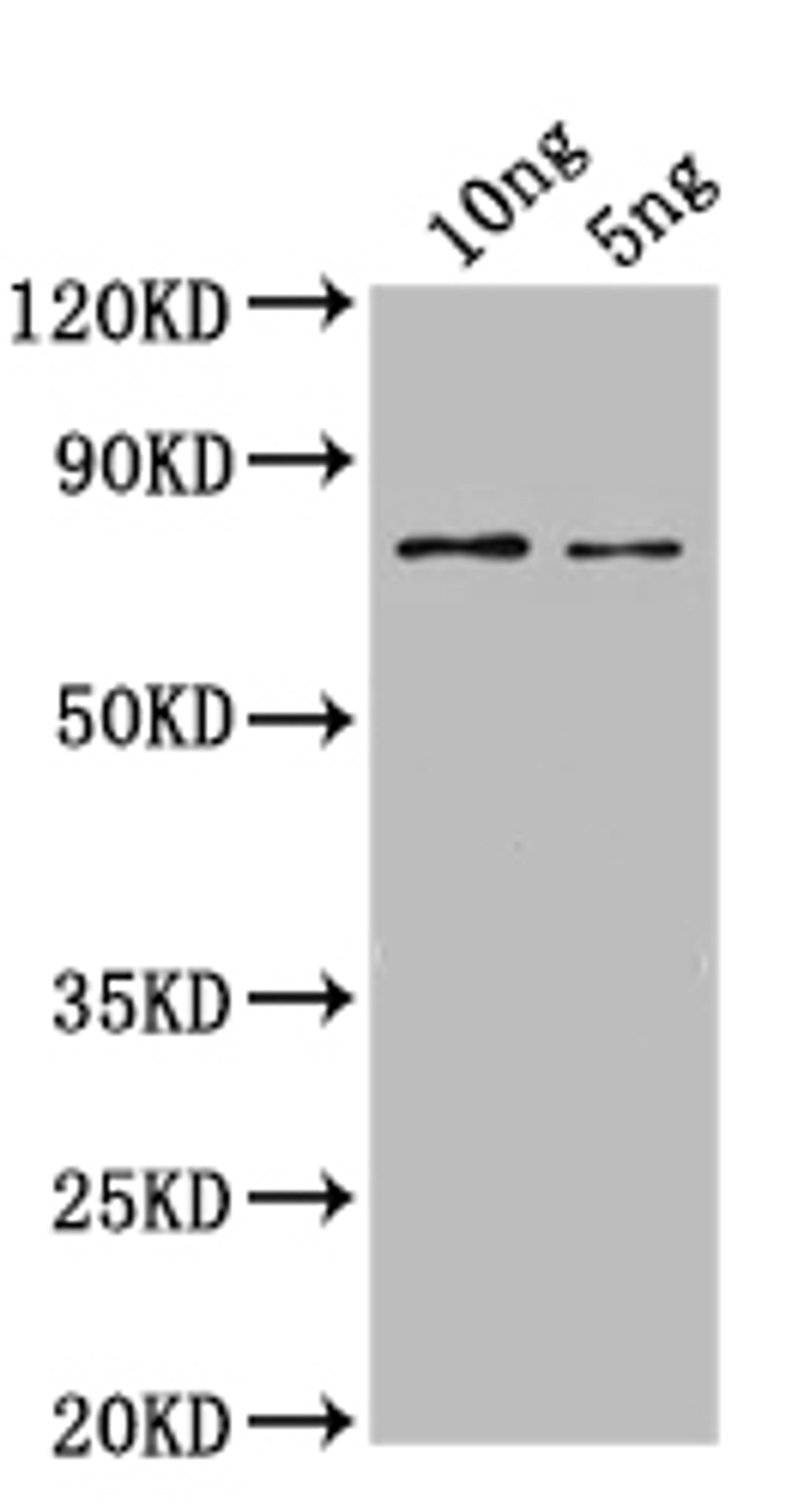 Western Blot. Positive WB detected in: recombinant protein. All lanes: SPT16 Antibody at 1:1000. Secondary. Goat polyclonal to rabbit IgG at 1/50000 dilution. Predicted band size: 65 kDa. Observed band size: 65 kDa.