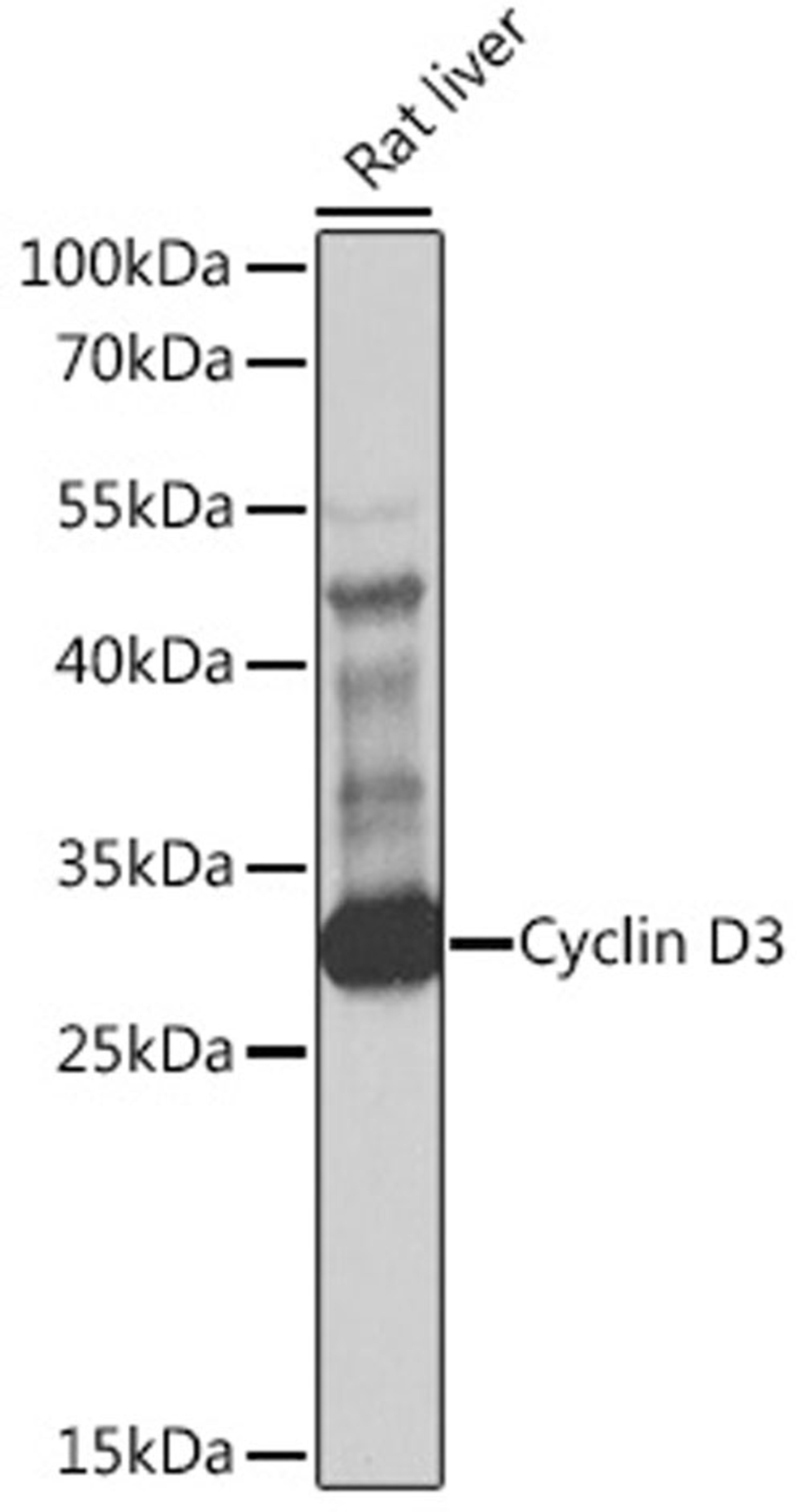 Western blot - Cyclin D3 antibody (A1084)