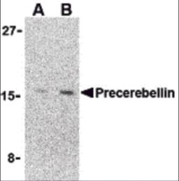 Western blot analysis of precerebellin in 293 cell lysate with precerebellin antibody at (A) 2 and (B) 4 &#956;g/mL.