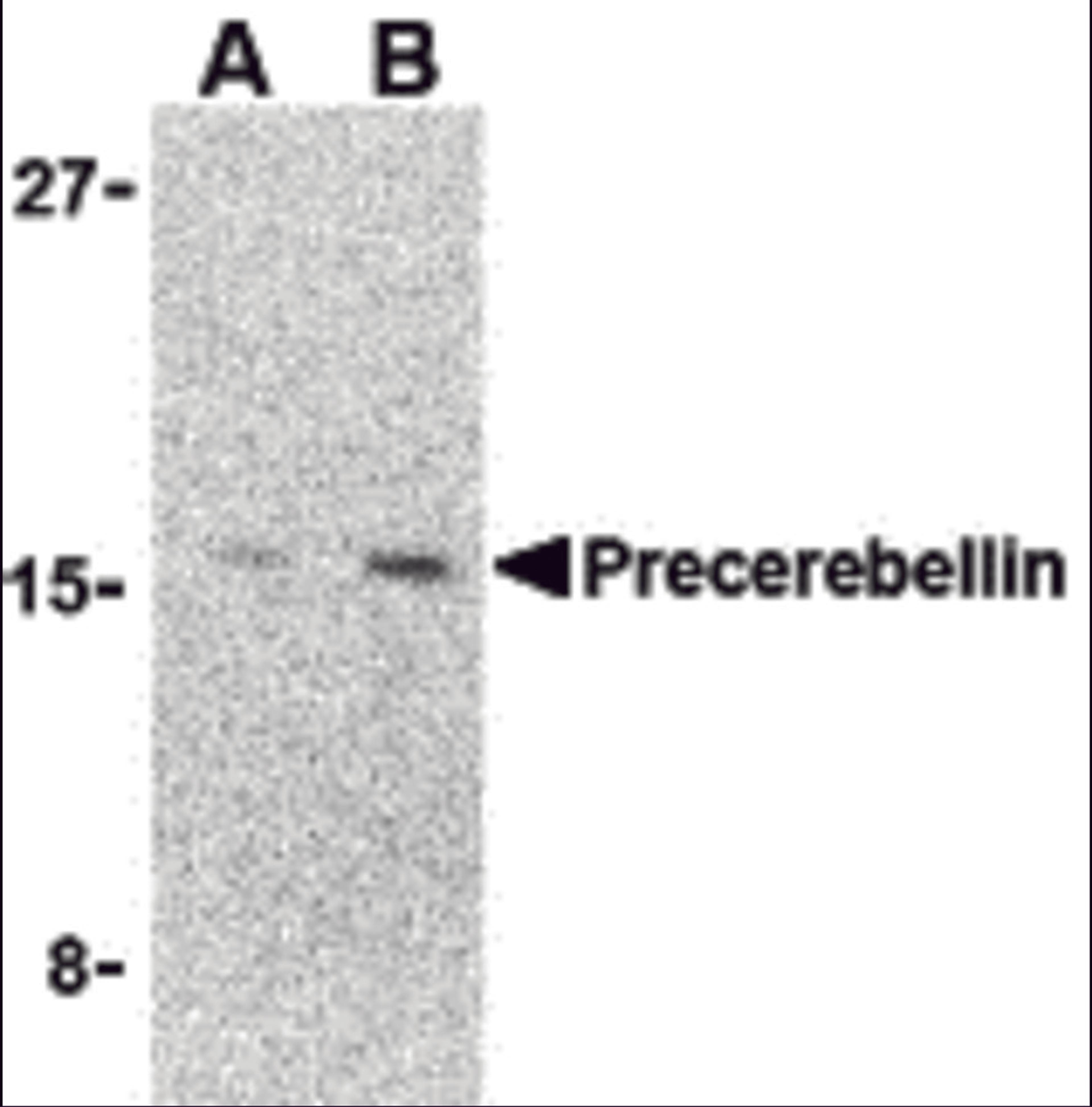 Western blot analysis of precerebellin in 293 cell lysate with precerebellin antibody at (A) 2 and (B) 4 &#956;g/mL.