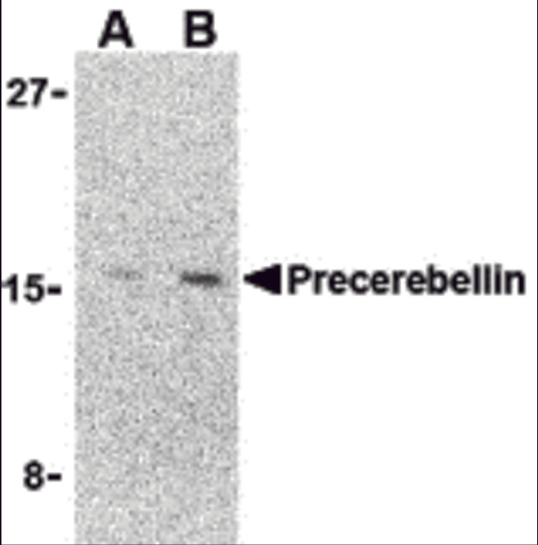 Western blot analysis of precerebellin in 293 cell lysate with precerebellin antibody at (A) 2 and (B) 4 μg/mL.