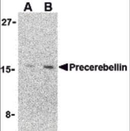 Western blot analysis of precerebellin in 293 cell lysate with precerebellin antibody at (A) 2 and (B) 4 μg/mL.