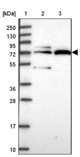 Western Blot: SLC28A2 Antibody [NBP2-33451] - Lane 1: Marker [kDa] 250, 130, 95, 72, 55, 36, 28, 17, 10<br/>Lane 2: Human cell line RT-4<br/>Lane 3: Human cell line U-251MG sp