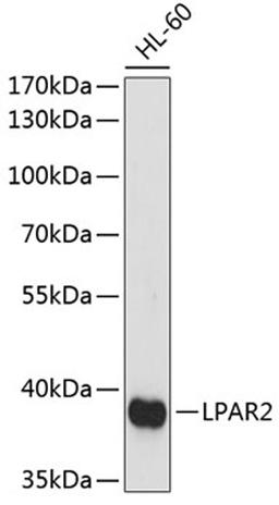 Western blot - LPAR2 antibody (A14819)