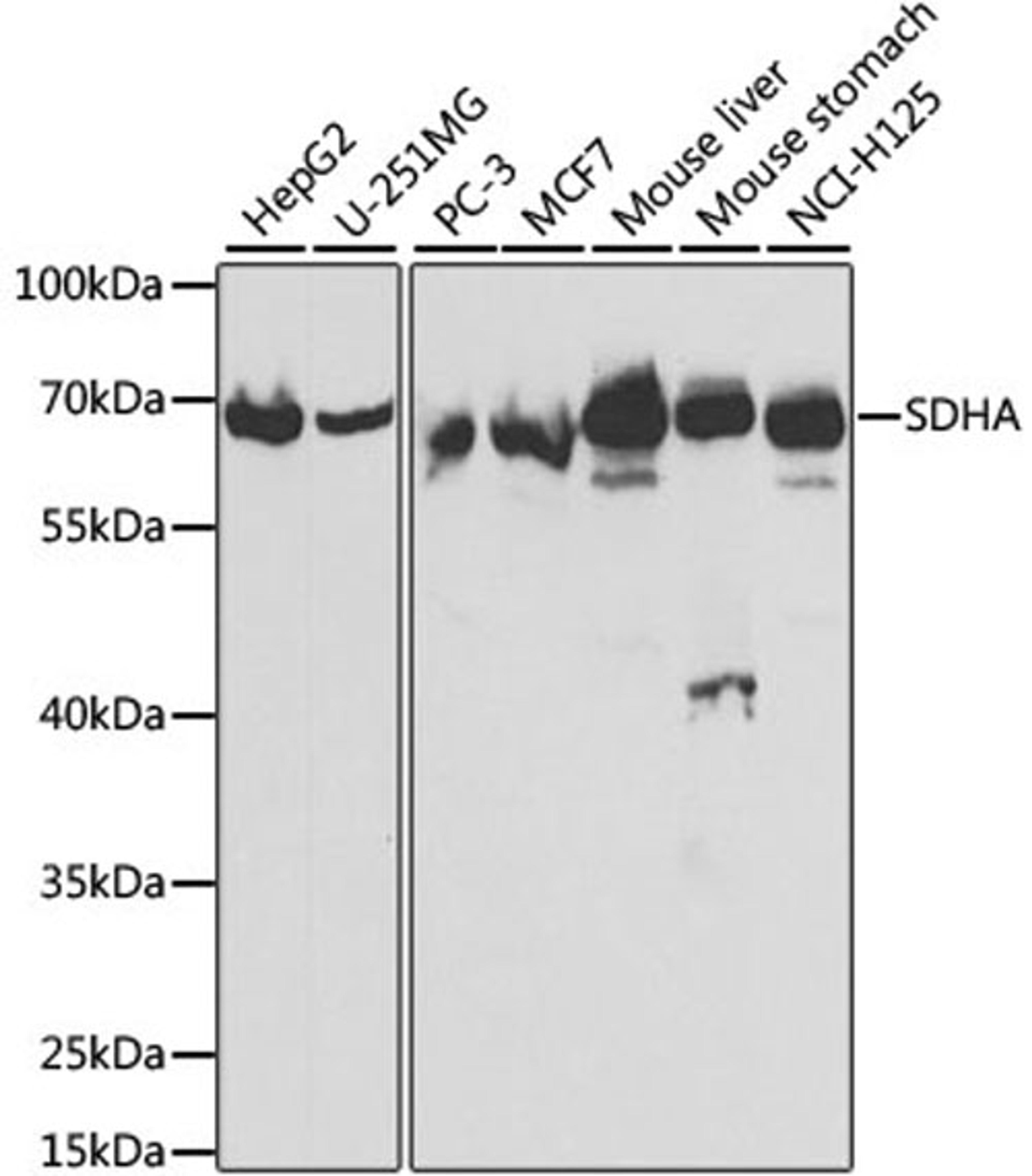 Western blot - SDHA antibody (A2594)