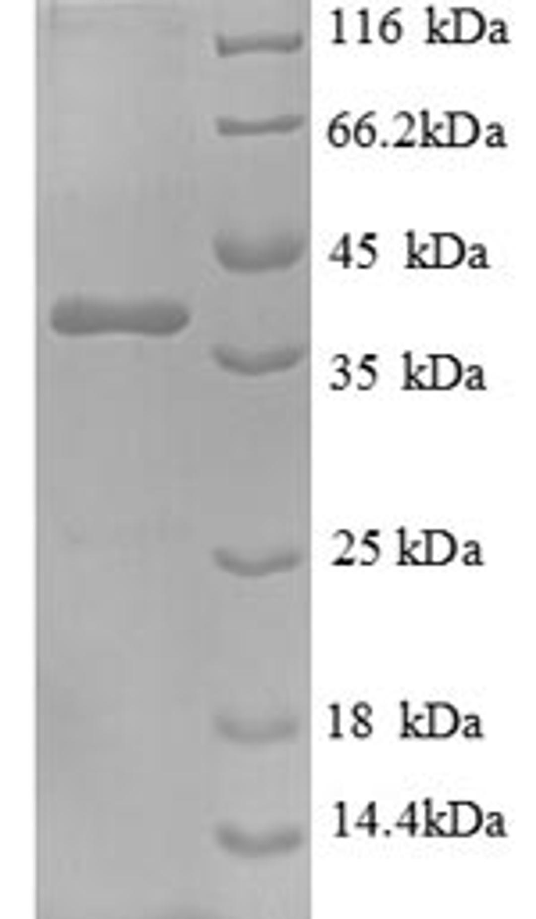 (Tris-Glycine gel) Discontinuous SDS-PAGE (reduced) with 5% enrichment gel and 15% separation gel.
