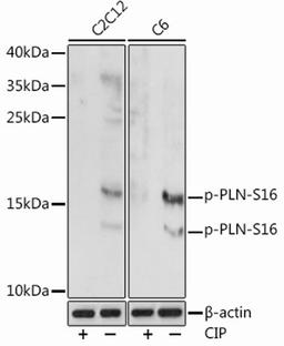 Western blot - Phospho-PLN-S16 antibody (AP0907)