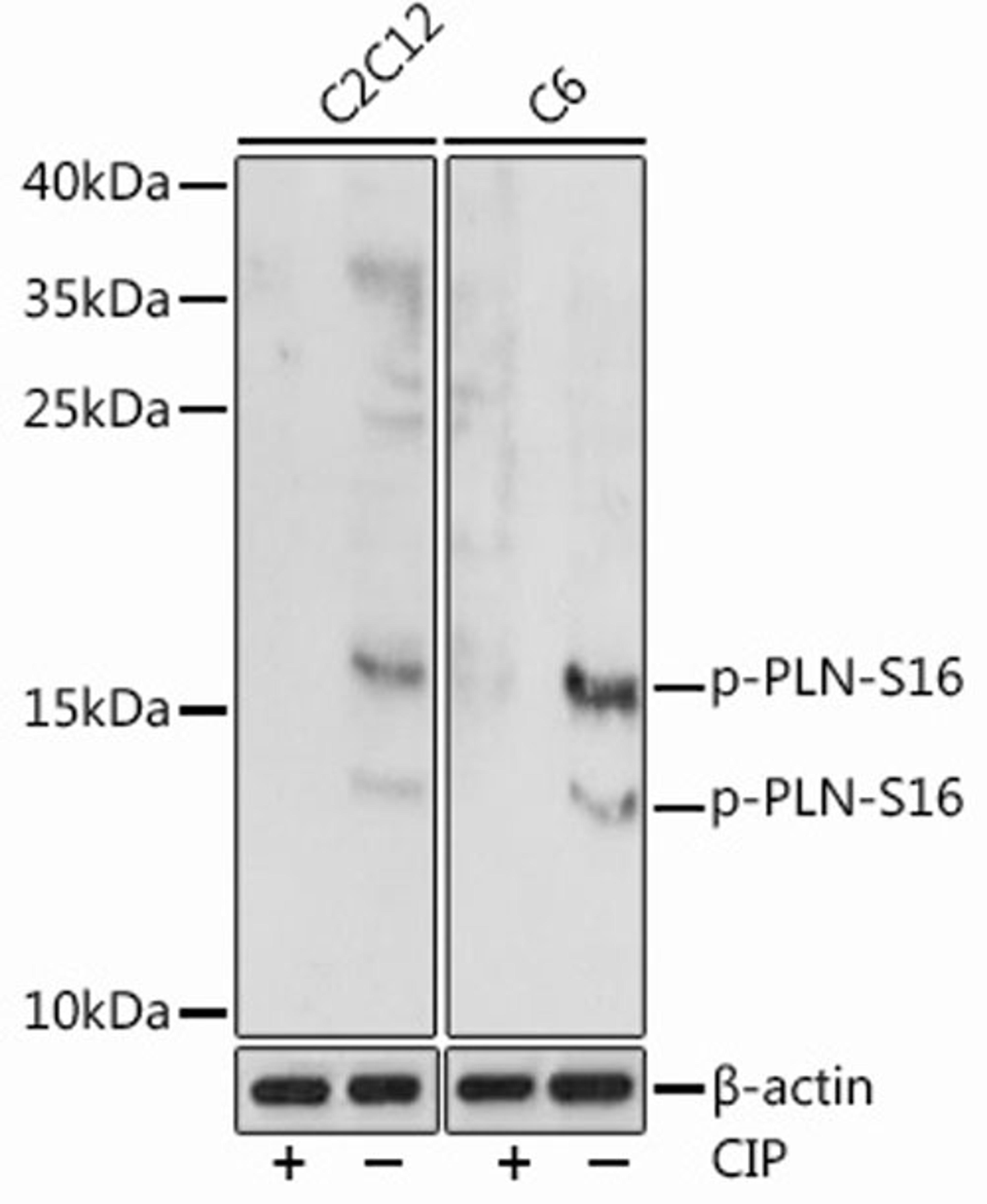 Western blot - Phospho-PLN-S16 antibody (AP0907)