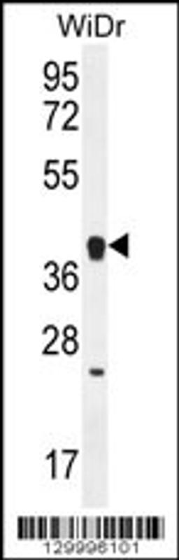 Western blot analysis in WiDr cell line lysates (35ug/lane).