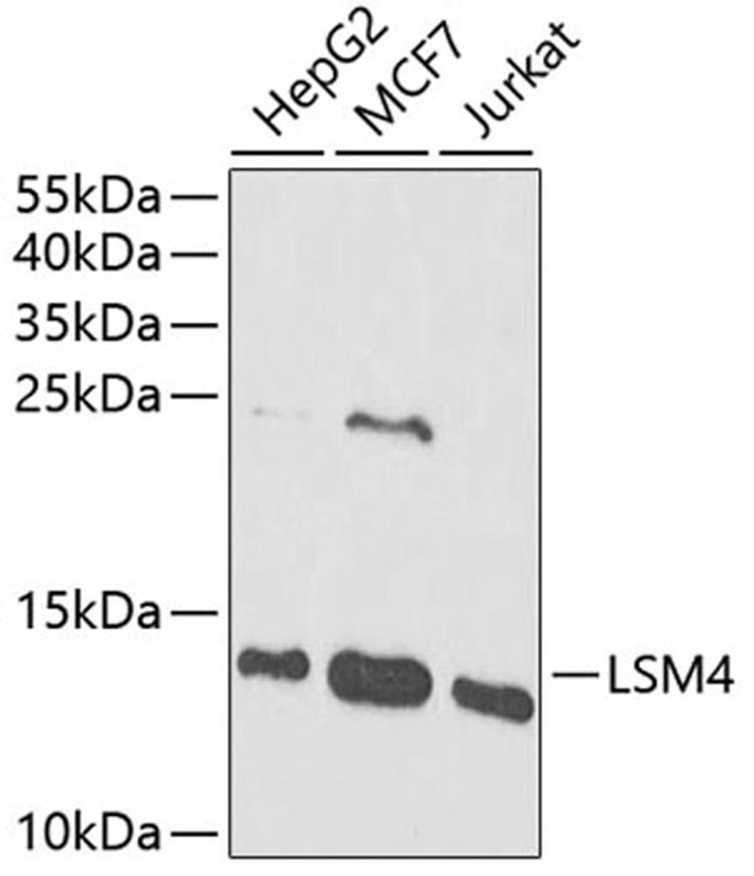 Western blot - LSM4 antibody (A13588)