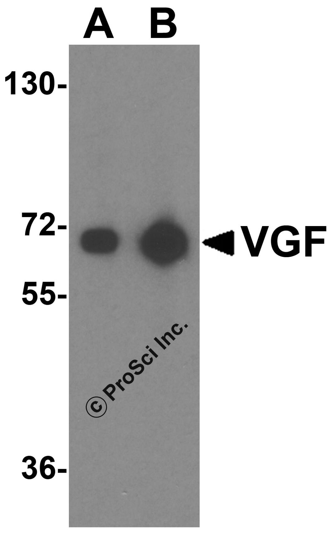 Western blot analysis of VGF expression in human brain tissue lysate with VGF antibody at (A) 1 and (B) 2 μg/ml.