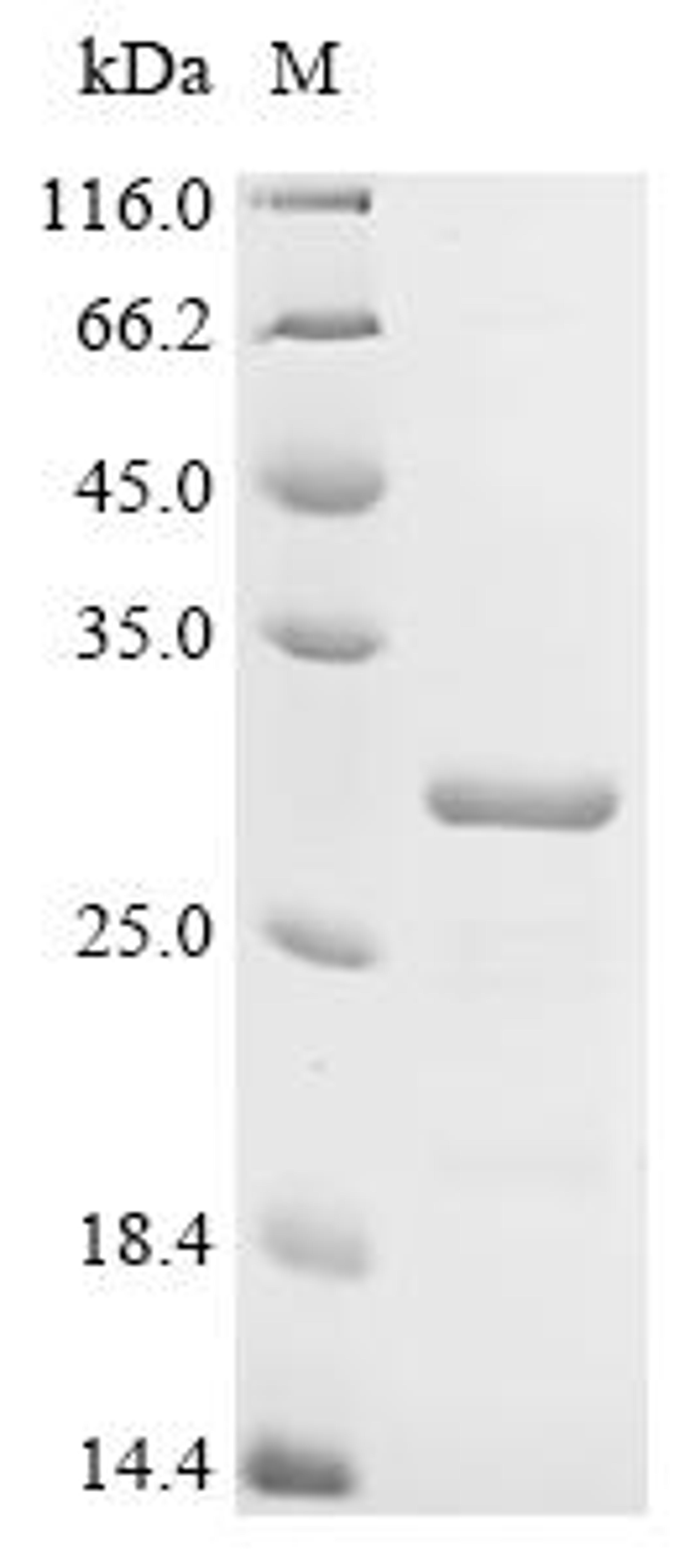 (Tris-Glycine gel) Discontinuous SDS-PAGE (reduced) with 5% enrichment gel and 15% separation gel.