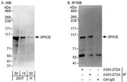 Detection of human SPICE by western blot and immunoprecipitation.