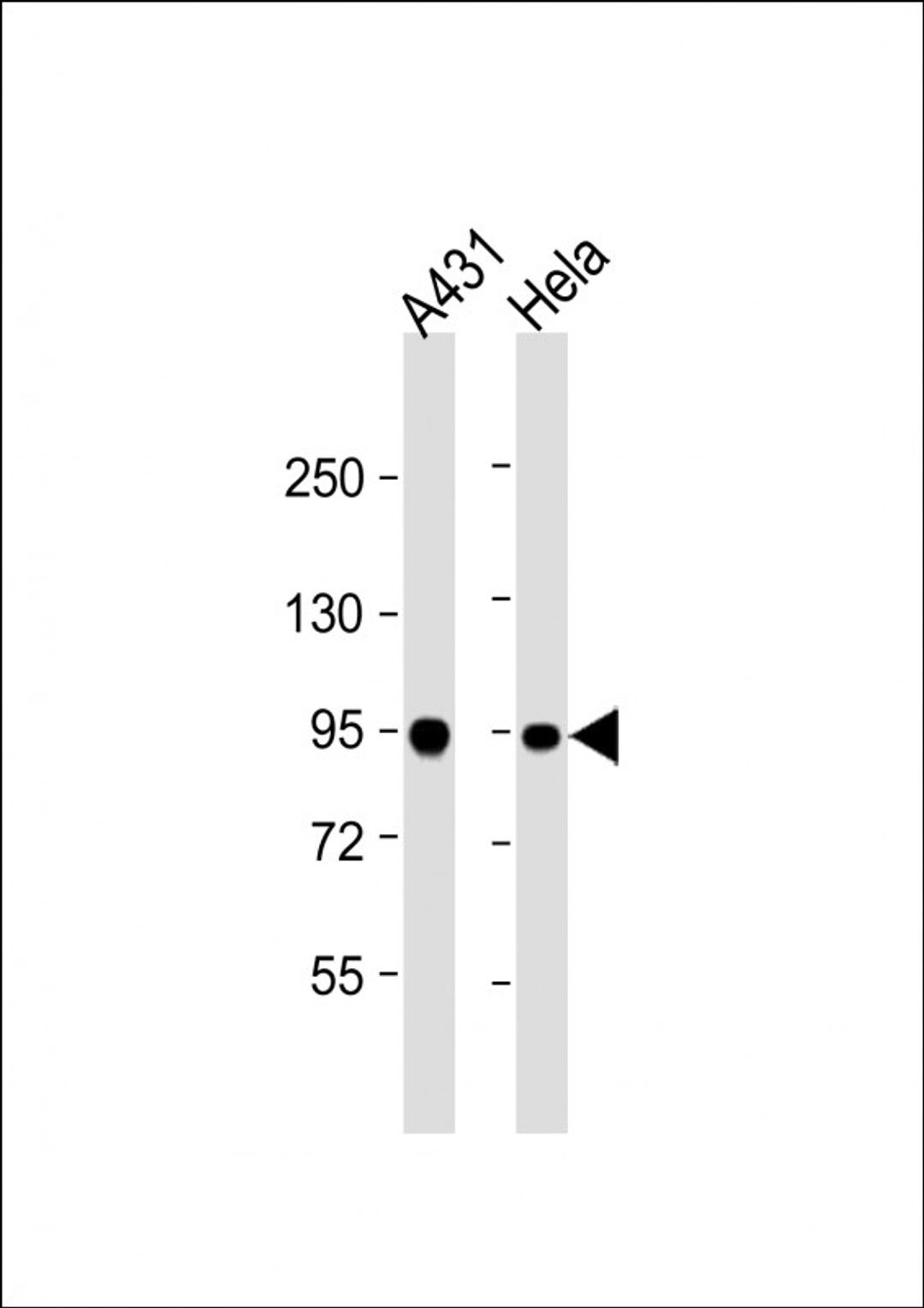 Western Blot at 1:1000 dilution Lane 1: A431 whole cell lysate Lane 2: Hela whole cell lysate Lysates/proteins at 20 ug per lane.